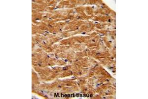 FGF7 antibody (Center) immunohistochemistry analysis in formalin fixed and paraffin embedded human M. (FGF7 抗体  (Middle Region))