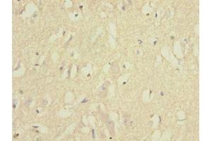 Immunohistochemistry of paraffin-embedded human brain tissue using ABIN7151859 at dilution of 1:100 (EPH Receptor B1 抗体  (AA 260-500))