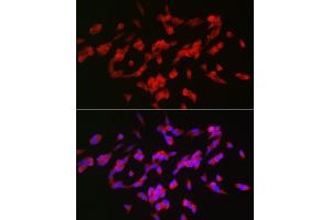 Immunofluorescence analysis of SH-SY5Y cells using G Rabbit pAb (ABIN6127469, ABIN6140954, ABIN6140955 and ABIN6221997) at dilution of 1:25 (40x lens). (GAP43 抗体  (AA 1-238))