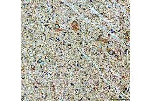 IHC analysis of Chat using anti-Chat antibody (ABIN7600421).