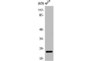 Western Blot analysis of COLO205 cells using PPP1R14D Polyclonal Antibody (PPP1R14D 抗体  (Internal Region))