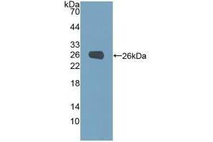 Detection of Recombinant PGM1, Human using Polyclonal Antibody to Phosphoglucomutase 1 (PGM1) (Phosphoglucomutase 1 抗体  (AA 1-235))