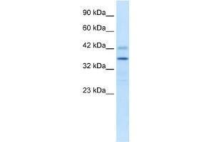 WB Suggested Anti-PRR7 Antibody Titration:  0. (PRR7 抗体  (Middle Region))