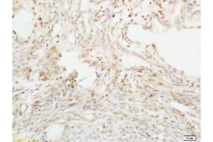 Formalin-fixed and paraffin embedded mouse uterus tissue labeled with Anti-ABP/SHBG Polyclonal Antibody, Unconjugated  at 1:200 followed by conjugation to the secondary antibody and DAB staining (SHBG 抗体  (AA 51-150))