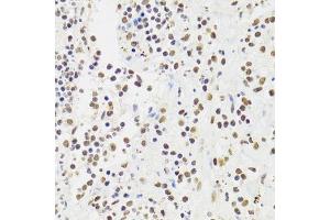 Immunohistochemistry of paraffin-embedded human appendicitis using XRCC6 Antibody.