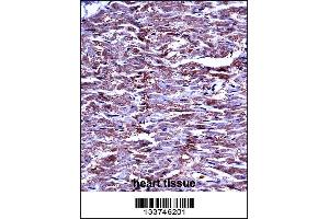 MMP15 Antibody immunohistochemistry analysis in formalin fixed and paraffin embedded human heart tissue followed by peroxidase conjugation of the secondary antibody and DAB staining. (MMP15 抗体  (N-Term))