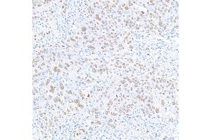 Immunohistochemistry (IHC) image for anti-RNA Binding Motif Protein 9 (RBM9) (AA 1-50) antibody (ABIN7454009) (Recombinant RBM9 抗体  (AA 1-50))