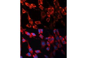 Immunofluorescence analysis of NIH/3T3 cells using CASP3 antibody. (Caspase 3 抗体  (AA 55-160))