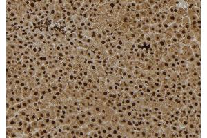 ABIN6279036 at 1/100 staining Rat liver tissue by IHC-P. (RPS27 抗体  (Internal Region))