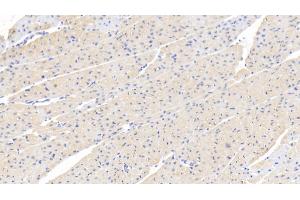 Detection of FOXO3 in Human Cardiac Muscle Tissue using Polyclonal Antibody to Forkhead Box Protein O3 (FOXO3) (FOXO3 抗体  (AA 369-633))