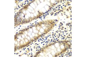 Immunohistochemistry of paraffin-embedded human colon using GNB2L1 antibody (ABIN6292957) at dilution of 1:100 (40x lens). (GNB2L1 抗体)
