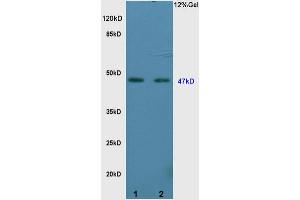 L1 rat brain lysates L2 rat kidney lysates probed with Anti Vitamin D Receptor/VDR Polyclonal Antibody, Unconjugated (ABIN682513) at 1:200 overnight at 4 °C. (Vitamin D Receptor 抗体  (AA 65-180))