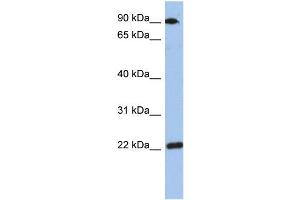 WB Suggested Anti-TMED10 Antibody Titration: 0. (TMED10 抗体  (Middle Region))