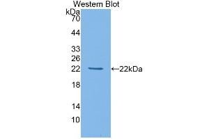 Detection of Recombinant HDAC4, Mouse using Polyclonal Antibody to Histone Deacetylase 4 (HDAC4) (HDAC4 抗体  (AA 904-1076))