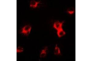 Immunofluorescent analysis of delta-Sarcoglycan staining in U2OS cells. (SGCD 抗体)