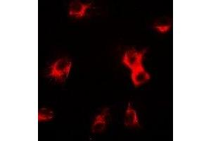 Immunofluorescent analysis of delta-Sarcoglycan staining in U2OS cells.