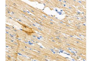 ABIN7094550 and ABIN7098599 at 1/100 staining Rat heart tissue by IHC-P.