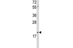 Western blot analysis of DLK2 antibody and HL-60 lysate. (DLK2 抗体  (AA 353-380))