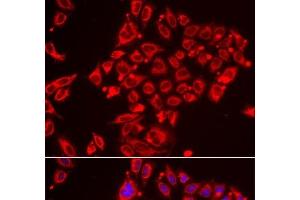 Immunofluorescence analysis of HeLa cells using ST3GAL3 Polyclonal Antibody (ST3GAL3 抗体)