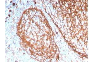 Formalin-fixed, paraffin-embedded human tonsil stained with CD11b Monospecific Mouse Monoclonal Antibody (ITGAM/3338). (CD11b 抗体  (AA 941-1074))