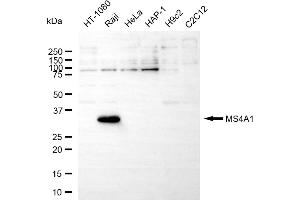 Western blotting analysis using MS4A1 antibody (ABIN7799370).