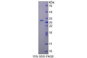 SDS-PAGE analysis of Rat PCM1 Protein. (PCM1 蛋白)