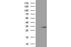 HEK293T cells were transfected with the pCMV6-ENTRY control (Left lane) or pCMV6-ENTRY C16orf72 (Right lane) cDNA for 48 hrs and lysed. (C16orf72 抗体)