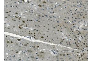 IHC analysis of PCBP2/hnRNP E2 using anti-PCBP2/hnRNP E2 antibody (ABIN7600449). (PCBP2 抗体  (AA 197-276))