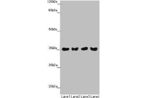 Western blot All lanes: TOMM34 antibody at 1. (TOMM34 抗体  (AA 1-309))
