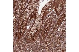 Immunohistochemical staining of human stomach with FAM186A polyclonal antibody  shows strong cytoplasmic positivity in glandular cells. (FAM186A 抗体)