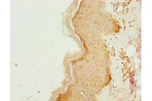 Immunohistochemistry of paraffin-embedded human skin tissue using ABIN7148168 at dilution of 1:100 (CCDC89 抗体  (AA 1-200))