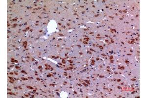 Immunohistochemistry (IHC) analysis of paraffin-embedded Rat Brain, antibody was diluted at 1:100. (HSP90 抗体  (Lys284, Lys292))