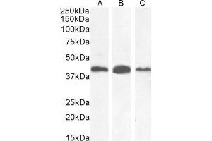 (ABIN2613379) (0. (AMACR 抗体  (AA 312-326))