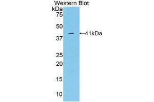 Western blot analysis of the recombinant protein. (Osteocalcin 抗体  (AA 11-98))
