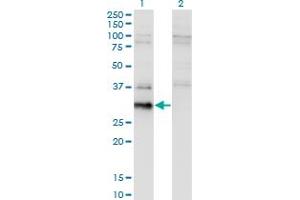 Western Blot analysis of BCL7B expression in transfected 293T cell line by BCL7B monoclonal antibody (M02), clone 4G1. (BCL7B 抗体  (AA 124-202))