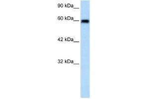 WB Suggested Anti-VMD2L2 Antibody Titration:  1. (Bestrophin 4 抗体  (N-Term))