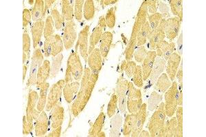 Immunohistochemistry of paraffin-embedded Rat heart using CA3 Polyclonal Antibody at dilution of 1:100 (40x lens). (CA3 抗体)