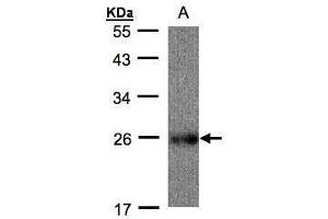 WB Image Sample(30 ug whole cell lysate) A: Raji, 12% SDS PAGE antibody diluted at 1:500 (UQCRFS1 抗体)