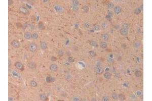 Detection of CHRM1 in Rat Cerebrum Tissue using Polyclonal Antibody to Cholinergic Receptor, Muscarinic 1 (CHRM1)