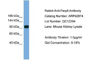 WB Suggested Anti-Parp8 Antibody Titration:  0. (PARP8 抗体  (N-Term))