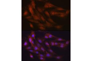Immunofluorescence analysis of C6 cells using K48-linkage Specific Ubiquitin Rabbit mAb (ABIN1680189, ABIN3017871, ABIN3017872 and ABIN7101530) at dilution of 1:100 (40x lens). (Ubiquitin B 抗体)