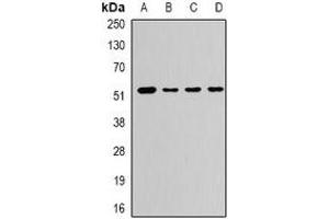 Western blot analysis of CaMK1 gamma expression in PC12 (A), A673 (B), mouse liver (C), rat brain (D) whole cell lysates. (CAMK1G 抗体)