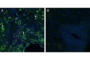 Expression of Calcitonin Receptor-Like Receptor in mouse brain stem - Immunohistochemical staining of perfusion-fixed frozen mouse brain sections with Anti-CRLR/CALCRL (extracellular) (extracellular) Antibody (ABIN7042979, ABIN7044198 and ABIN7044199), (1:200), followed by goat anti-rabbit-AlexaFluor-488. (CALCRL 抗体  (C-Term, Intracellular))