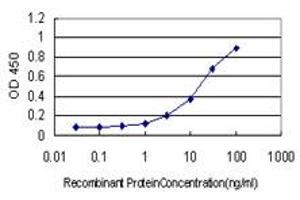 Detection limit for recombinant GST tagged ATR is approximately 0. (ATR 抗体  (AA 2545-2644))