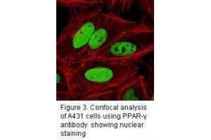 Image no. 3 for anti-Peroxisome Proliferator-Activated Receptor gamma (PPARG) antibody (ABIN232120) (PPARG 抗体)