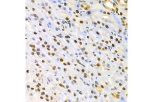 Immunohistochemistry of paraffin-embedded rat kidney using SFN Antibody. (14-3-3 sigma/SFN 抗体)