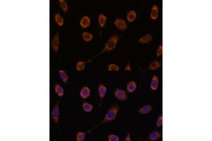 Immunofluorescence analysis of L929 cells using CCT6B antibody (ABIN7270709) at dilution of 1:100. (CCT6B 抗体  (AA 120-340))