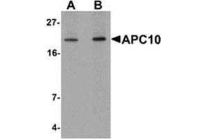 Western blot analysis of APC10 in mouse heart tissue lysate with APC10 antibody at (A) 1 and (B) 2 μg/ml. (ANAPC10 抗体  (Center))