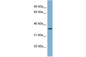 WB Suggested Anti-C1orf75 Antibody Titration:  0. (TMEM206 抗体  (N-Term))