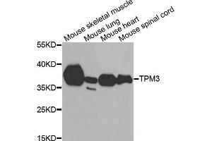 Western blot analysis of extracts of various cell lines, using TPM3 antibody (ABIN6291029) at 1:1000 dilution. (TPM3 抗体)